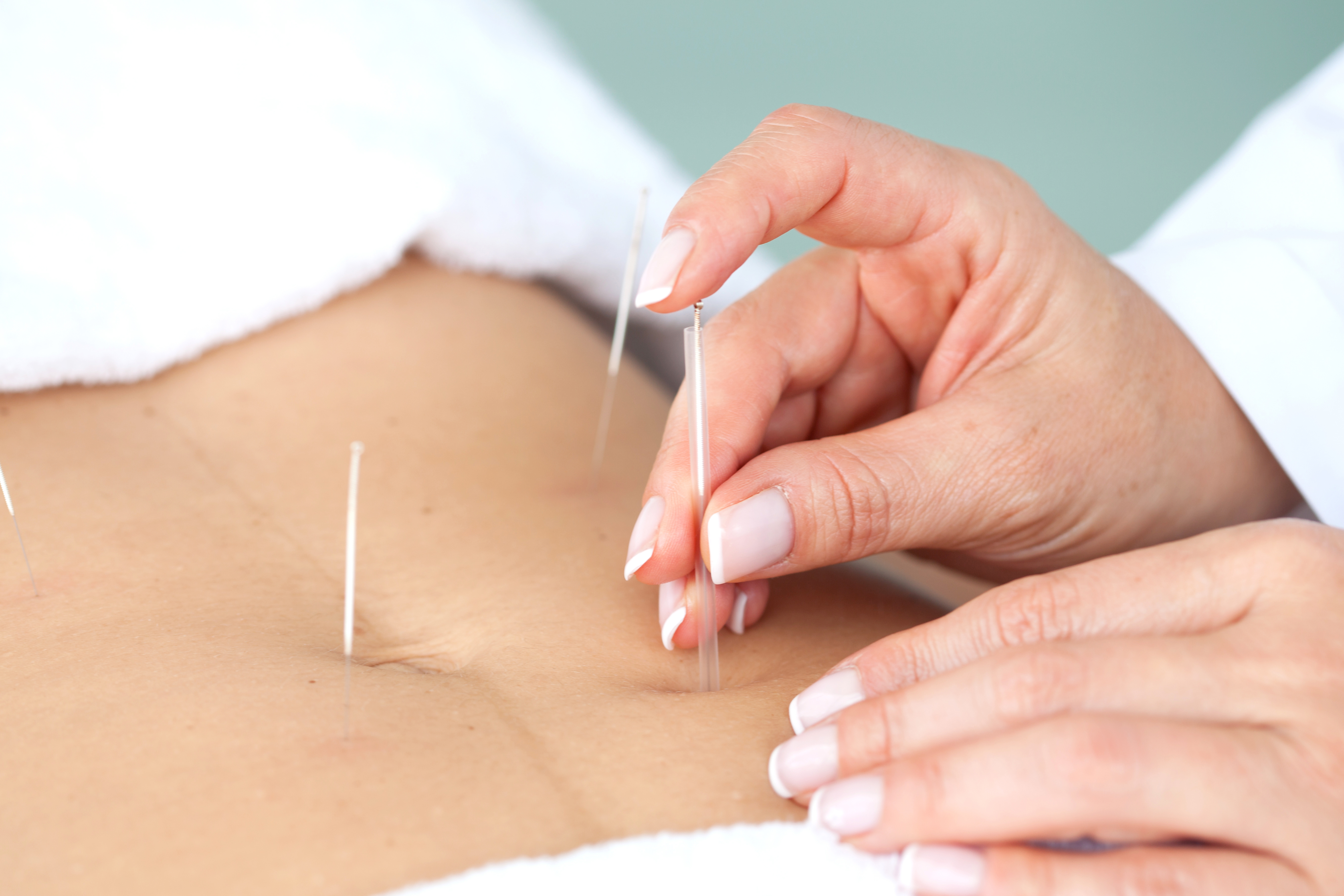 Weight Loss and Body Sculpting Acupuncture
