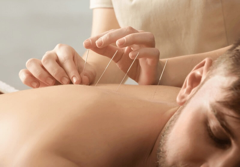 Chiro - Acupuncture