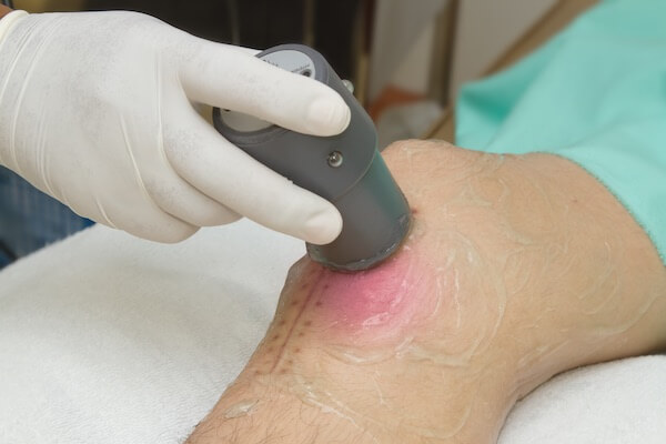 ultrasound