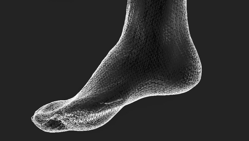 Custom Orthotics - Assessment